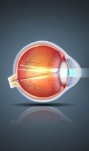 astigmatism-causes-symptoms-astigmatism-test-treatment-explained-920x425 (1)